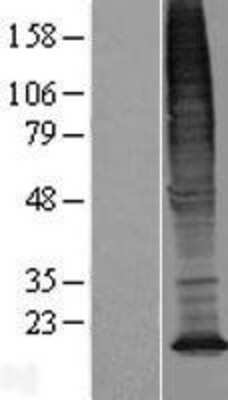 Western Blot: TMEM128 Overexpression Lysate (Adult Normal) [NBL1-17008] Left-Empty vector transfected control cell lysate (HEK293 cell lysate); Right -Over-expression Lysate for TMEM128.