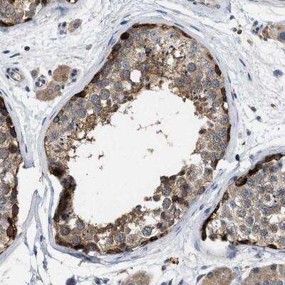 Immunohistochemistry TMEM131 Antibody