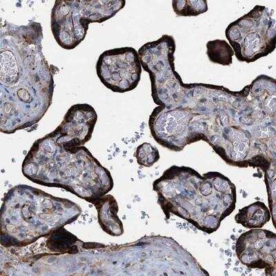 Immunohistochemistry TMEM131 Antibody