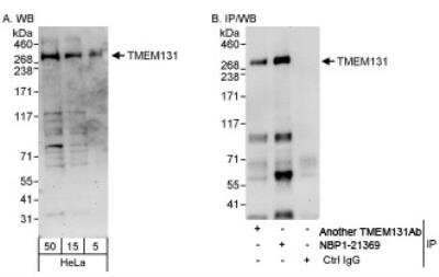 Western Blot TMEM131 Antibody