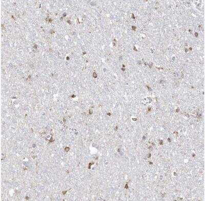 Immunohistochemistry-Paraffin TMEM132B Antibody - BSA Free