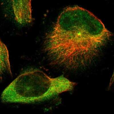 Immunocytochemistry/Immunofluorescence: TMEM132C Antibody [NBP1-90497] - Immunofluorescent staining of human cell line U-251 MG shows localization to cytosol & centrosome.