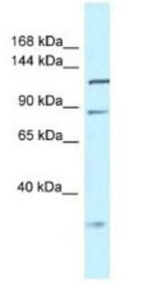 Western Blot: TMEM132D Antibody [NBP1-91366] - Mouse Liver Lysate 1ug/ml  Gel Concentration 6-18%