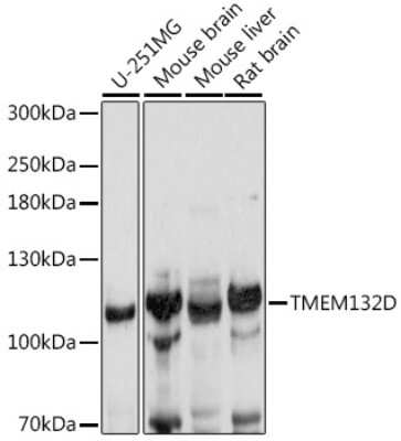 Western Blot: TMEM132D Antibody [NBP2-93918] - Analysis of extracts of various cell lines, using TMEM132D at 1:1000 dilution. Secondary antibody: HRP Goat Anti-Rabbit IgG (H+L) at 1:10000 dilution. Lysates/proteins: 25ug per lane. Blocking buffer: 3% nonfat dry milk in TBST. Detection: ECL Basic Kit . Exposure time: 1s.