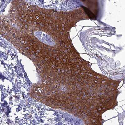 Immunohistochemistry-Paraffin: TMEM134 Antibody [NBP1-82136] - Staining of human skin shows strong cytoplasmic positivity in epidermal cells.
