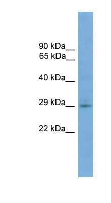 Western Blot: TMEM139 Antibody [NBP1-70726] - COLO205 cells lysate, concentration 0.2-1 ug/ml.