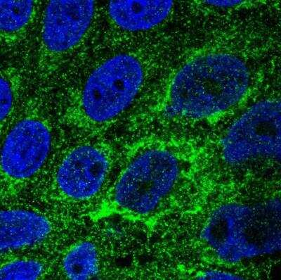 Immunocytochemistry/Immunofluorescence: TMEM141 Antibody [NBP1-81207] - Staining of human cell line CACO-2 shows localization to mitochondria. Antibody staining is shown in green.