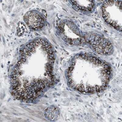 Immunohistochemistry-Paraffin: TMEM141 Antibody [NBP1-81207] - Staining of human prostate shows strong cytoplasmic positivity in glandular cells.
