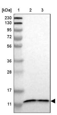 Western Blot: TMEM141 Antibody [NBP1-81207] - Lane 1: Marker [kDa] 230, 130, 95, 72, 56, 36, 28, 17, 11Lane 2: Human cell line RT-4Lane 3: Human cell line U-251MG sp