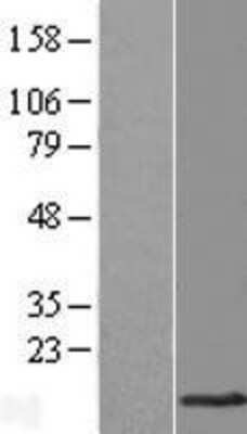 Western Blot: TMEM141 Overexpression Lysate (Adult Normal) [NBL1-17015] Left-Empty vector transfected control cell lysate (HEK293 cell lysate); Right -Over-expression Lysate for TMEM141.