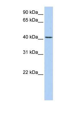 Western Blot: TMEM144 Antibody [NBP1-91310] - Human Lung lysate, concentration 0.2-1 ug/ml.
