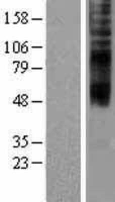 Western Blot: TMEM144 Overexpression Lysate (Adult Normal) [NBP2-04371] Left-Empty vector transfected control cell lysate (HEK293 cell lysate); Right -Over-expression Lysate for TMEM144.