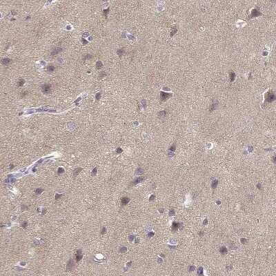 Immunohistochemistry-Paraffin: TMEM145 Antibody [NBP2-57030] - Immunohistochemical staining of human cerebral cortex shows weak cytoplasmic positivity in neuropil and a subset of neuronal cells.