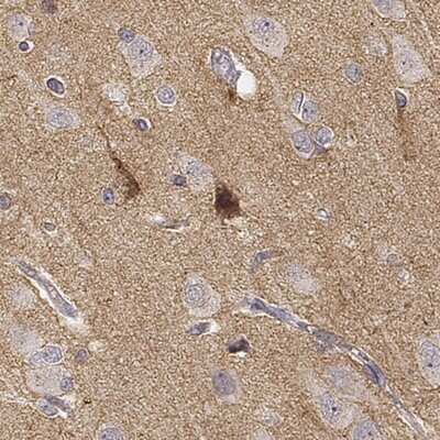 Immunohistochemistry-Paraffin: TMEM145 Antibody [NBP2-57030] - Staining of human cerebral cortex shows strong cytoplasmic positivity in a subset of neurons.