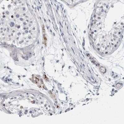 Immunohistochemistry-Paraffin: TMEM146 Antibody [NBP1-93475] - Staining of human testis shows moderate cytoplasmic positivity in Leydig cells.