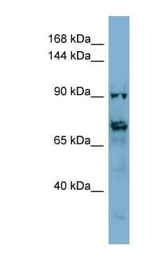Western Blot: TMEM146 Antibody [NBP1-91461] - HepG2 cell lysate, concentration 0.2-1 ug/ml.