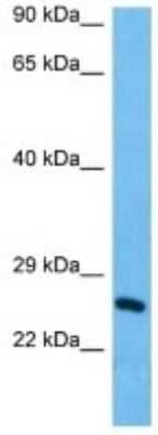 Western Blot TMEM150B Antibody