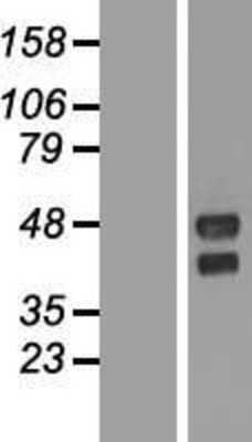 Western Blot TMEM151A Overexpression Lysate