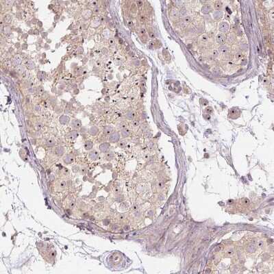 Immunohistochemistry-Paraffin: TMEM151B Antibody [NBP2-30694] - Staining of human testis shows moderate positivity in nucleoli in cells in seminiferous ducts.