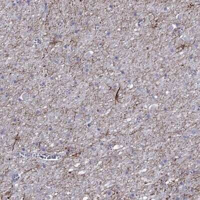 Immunohistochemistry-Paraffin: TMEM155 Antibody [NBP2-69046] - Staining of human cerebral cortex shows strong positivity in neuropil.