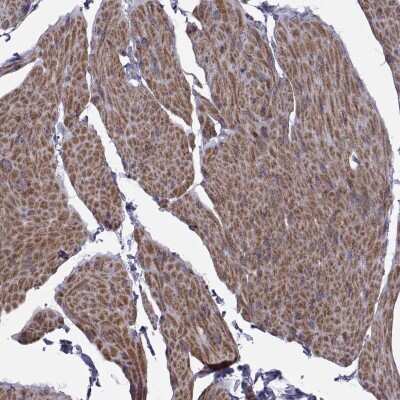 Immunohistochemistry-Paraffin TMEM158 Antibody - BSA Free