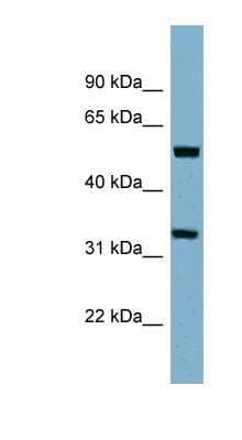 Western Blot TMEM158 Antibody