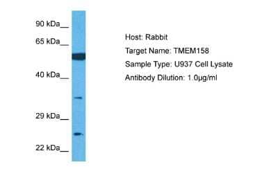 Western Blot TMEM158 Antibody