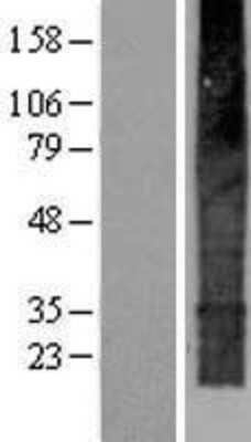 Western Blot: TMEM159 Overexpression Lysate (Adult Normal) [NBP2-06646] Left-Empty vector transfected control cell lysate (HEK293 cell lysate); Right -Over-expression Lysate for TMEM159.