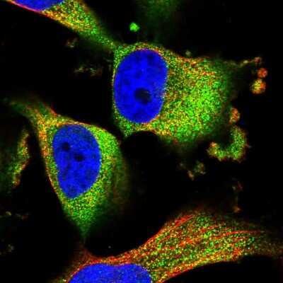 Immunocytochemistry/Immunofluorescence: TMEM161A Antibody [NBP1-93975] - Immunofluorescent staining of human cell line U-251 MG shows localization to cytosol.