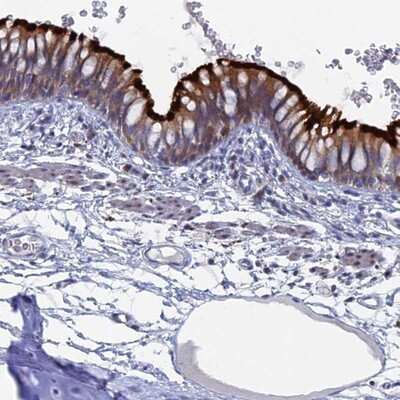 Immunohistochemistry-Paraffin: TMEM161A Antibody [NBP1-93975] - Staining of human bronchus shows strong membranous and cytoplasmic positivity in respiratory epithelial cells.