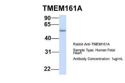 Western Blot: TMEM161A Antibody [NBP1-91304] - Human Fetal Heart, Antibody Dilution: 1.0 ug/ml.