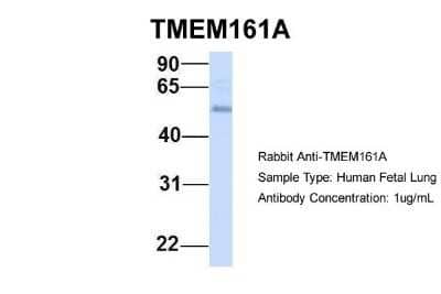 Western Blot: TMEM161A Antibody [NBP1-91304] - Human Fetal Lung, Antibody Dilution: 1.0 ug/ml.