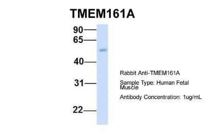 Western Blot: TMEM161A Antibody [NBP1-91304] - Human Fetal Muscle, Antibody Dilution: 1.0 ug/ml.