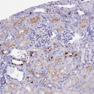 Immunohistochemistry-Paraffin: TMEM161B Antibody [NBP1-93488] - Staining of human kidney shows strong cytoplasmic positivity in fraction of cells in renal tubules.