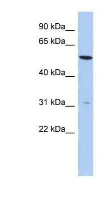 Western Blot: TMEM161B Antibody [NBP1-91442] - Titration: 0.2-1 ug/ml, Positive Control: HepG2 cell lysate.