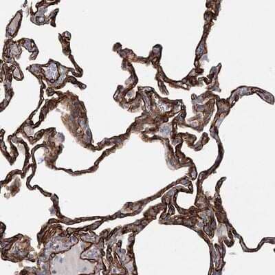 Immunohistochemistry-Paraffin: TMEM164 Antibody [NBP1-93939] - Staining of human lung shows strong cytoplasmic and membranous positivity in alveolar cells.