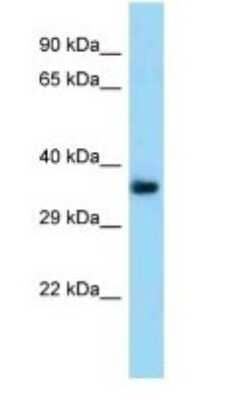 Western Blot: TMEM164 Antibody [NBP1-98383] - Titration: 1.0 ug/ml Positive Control: Mouse Kidney.