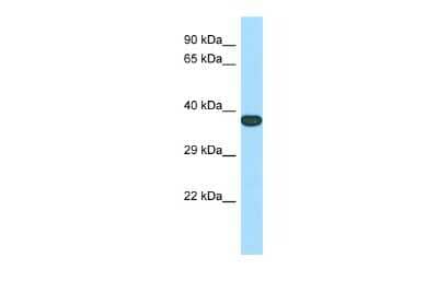 Western Blot: TMEM165 Antibody [NBP2-85937] - Host: Rabbit. Target Name: Tmem165. Sample Type: Mouse Stomach lysates. Antibody Dilution: 1.0ug/ml