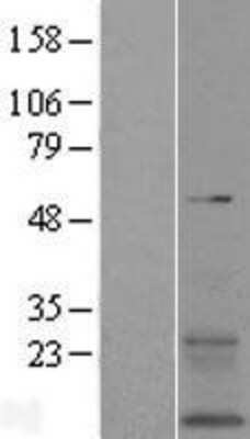 Western Blot: TMEM167B Overexpression Lysate (Adult Normal) [NBL1-17032] Left-Empty vector transfected control cell lysate (HEK293 cell lysate); Right -Over-expression Lysate for TMEM167B.