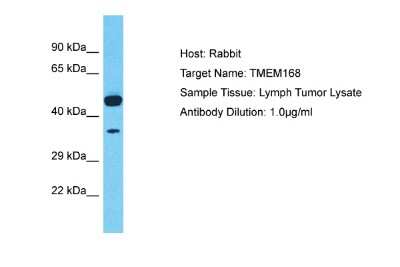 Western Blot: TMEM168 Antibody [NBP2-85938] - Host: Rabbit. Target Name: TMEM168. Sample Tissue: Human Lymph Tumor. Antibody Dilution: 1ug/ml