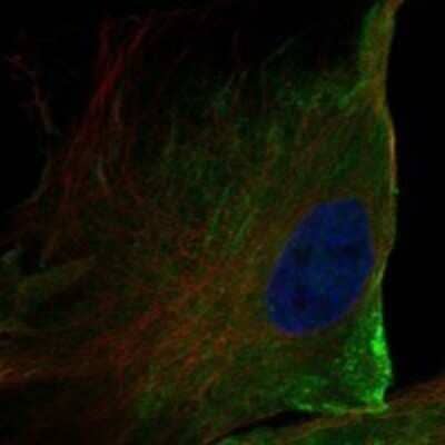 Immunocytochemistry/Immunofluorescence: TMEM16K Antibody [NBP3-17446] - Staining of human cell line BJ shows localization to plasma membrane.