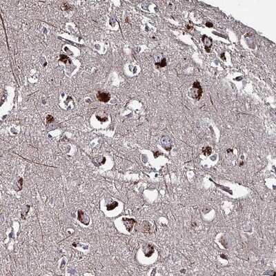 Immunohistochemistry-Paraffin: TMEM16K Antibody [NBP2-14297] - Staining of human cerebral cortex shows strong cytoplasmic positivity in neuronal cells.