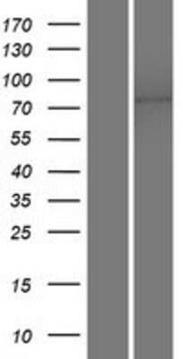 Western Blot: TMEM16K Overexpression Lysate (Adult Normal) [NBP2-06879] Left-Empty vector transfected control cell lysate (HEK293 cell lysate); Right -Over-expression Lysate for TMEM16K.