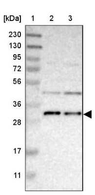 Western Blot: TMEM17 Antibody [NBP1-81974] - Lane 1: Marker  [kDa] 230, 130, 95, 72, 56, 36, 28, 17, 11.  Lane 2: Human cell line RT-4.  Lane 3: Human cell line U-251MG sp