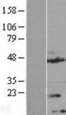 Western Blot: TMEM170A Overexpression Lysate (Adult Normal) [NBL1-17036] Left-Empty vector transfected control cell lysate (HEK293 cell lysate); Right -Over-expression Lysate for TMEM170A.