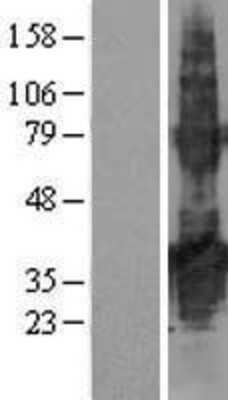 Western Blot TMEM171 Overexpression Lysate