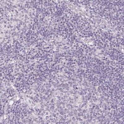 Immunohistochemistry-Paraffin: TMEM174 Antibody [NBP1-82023] - Staining of human lymph node shows low expression as expected.
