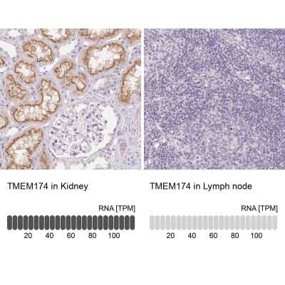 <b>Orthogonal Strategies Validation. </b>Immunohistochemistry-Paraffin: TMEM174 Antibody [NBP1-82023] - Staining in human kidney and lymph node tissues using anti-TMEM174 antibody. Corresponding TMEM174 RNA-seq data are presented for the same tissues.