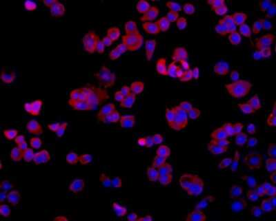 Immunocytochemistry/Immunofluorescence: TMEM177 Antibody (A6-A11) [NBP2-67213] - Staining TMEM177 in MCF-7 cells (red). The nuclear counter stain is DAPI (blue). Cells were fixed in paraformaldehyde, permeabilised with 0.25% Triton X100/PBS.