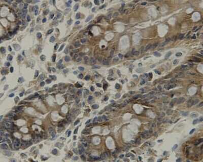 Immunohistochemistry-Paraffin: TMEM177 Antibody (A6-A11) [NBP2-67213] - Analysis of paraffin-embedded human colon tissue using anti-TMEM177 antibody. Counter stained with hematoxylin.